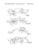 PROTECTIVE GLOVE HAVING SEGMENTED WRIST GUARD diagram and image