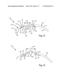 PROTECTIVE GLOVE HAVING SEGMENTED WRIST GUARD diagram and image