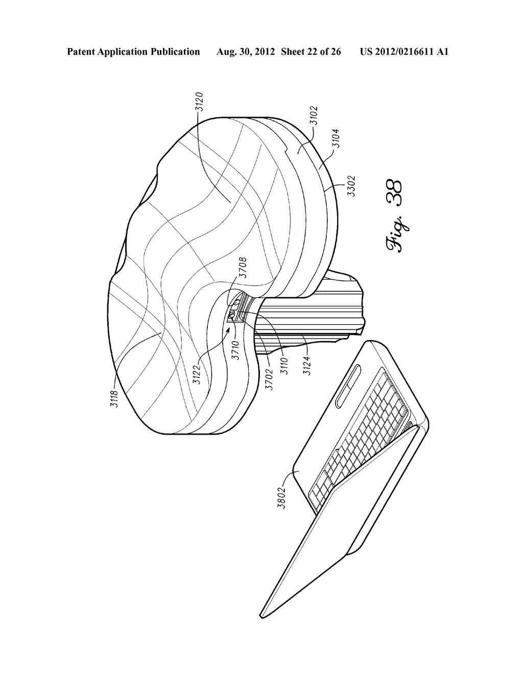 PROSTHETIC COMPONENT HAVING A COMPLIANT SURFACE - diagram, schematic, and image 23