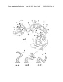 WATER SPORTS FOLDABLE TOWING APPARATUS AND METHOD diagram and image