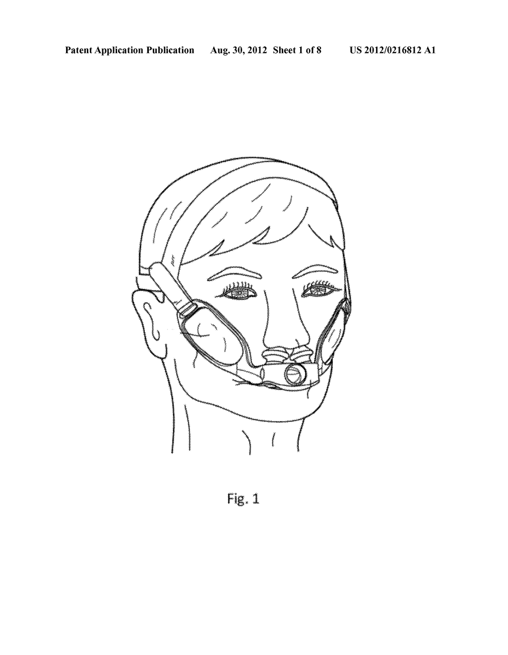 PATIENT INTERFACE ASSEMBLY WITH IMPROVED STABILIZATION - diagram, schematic, and image 02