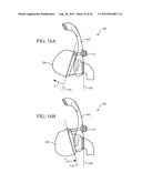 PATIENT INTERFACE WITH AN ADJUSTABLE CUSHION diagram and image