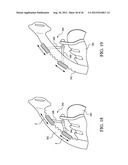 PATIENT INTERFACE WITH AN ADJUSTABLE CUSHION diagram and image