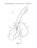 PATIENT INTERFACE WITH AN ADJUSTABLE CUSHION diagram and image