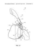 PATIENT INTERFACE WITH AN ADJUSTABLE CUSHION diagram and image