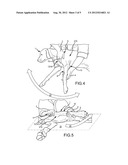 Joint Stabilized Straight Plane Movement Stretching System diagram and image