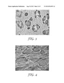 PRESSURE SENSITIVE ADHESIVE COMPRISING BLEND OF SYNTHETIC RUBBER AND     FUNCTIONALIZED SYNTHETIC RUBBER BONDED TO AN ACYLIC POLYMER diagram and image