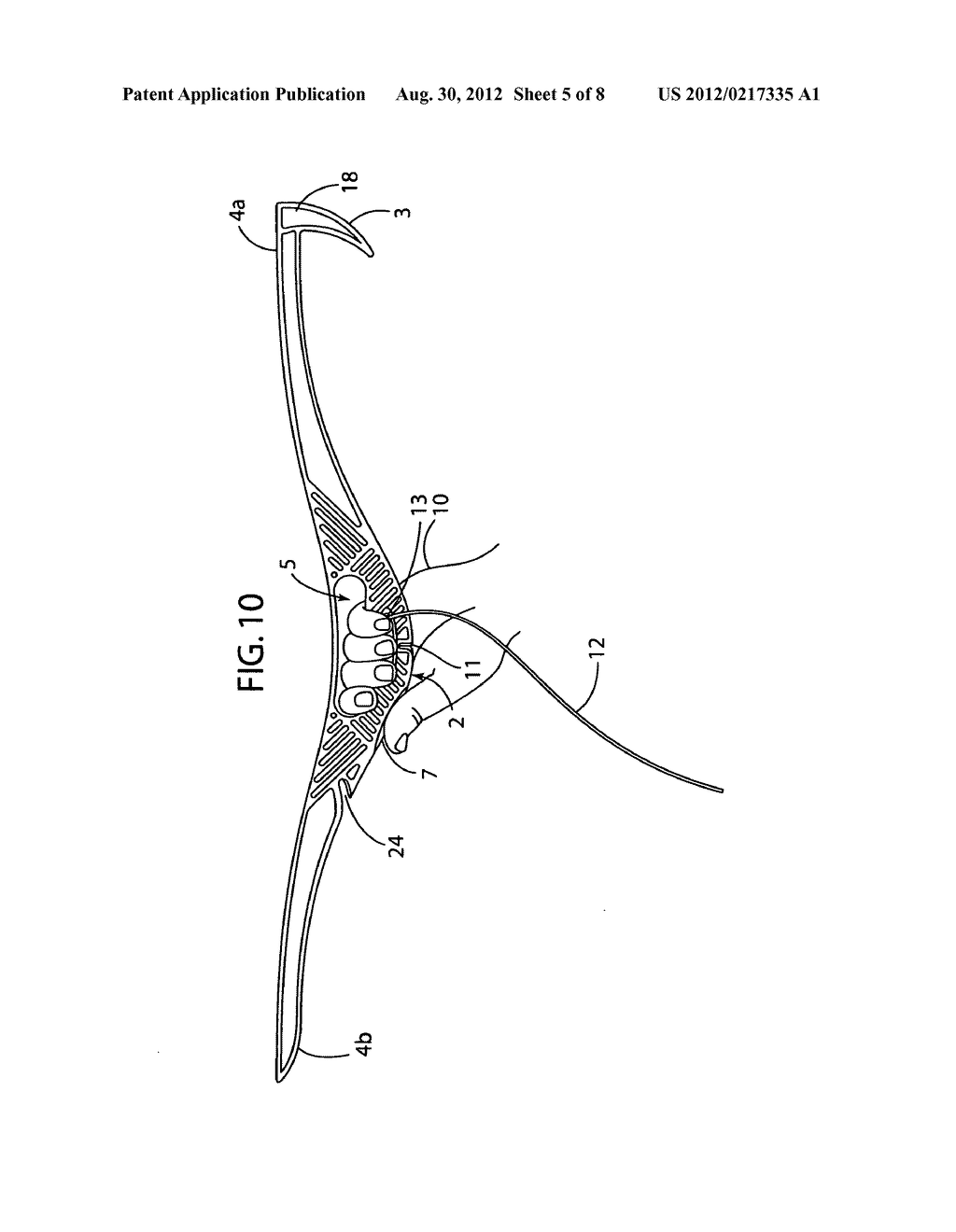 Wound rope or cord support - diagram, schematic, and image 06