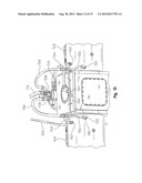 Dry Axle Center Section diagram and image