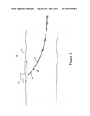 METHOD AND DEVICE TO ACQUIRE SEISMIC DATA diagram and image