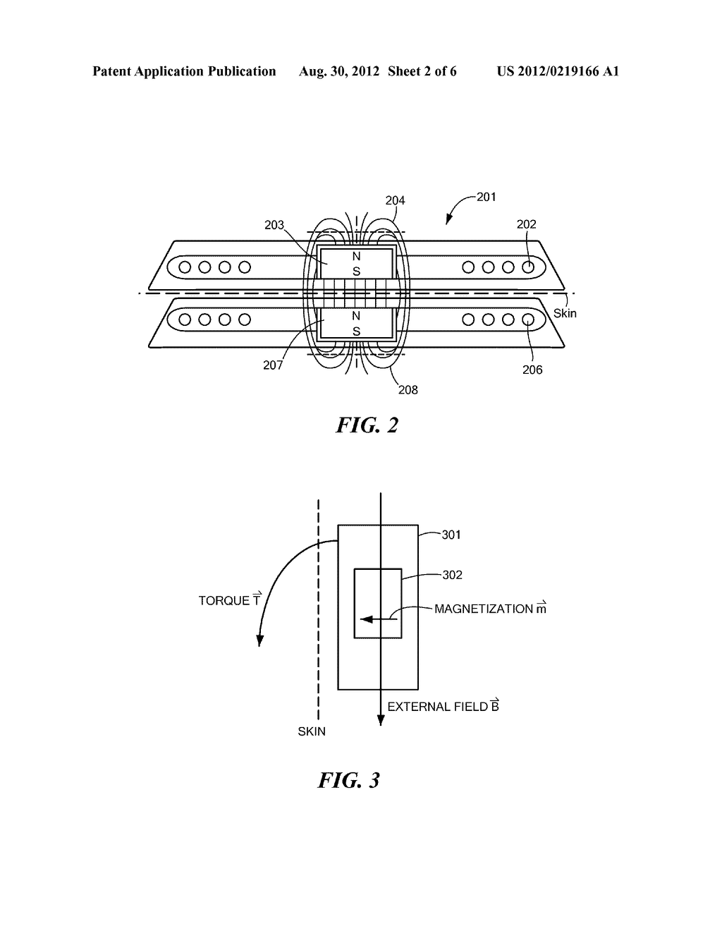 MRI Safe Actuator for Implantable Floating Mass Transducer - diagram, schematic, and image 03