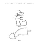 UNIVERSAL FLEXIBLE IN-THE-EAR HEARING AID diagram and image