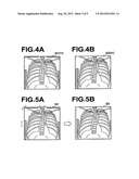 ALIGNING APPARATUS, ALIGNING METHOD, AND THE PROGRAM diagram and image