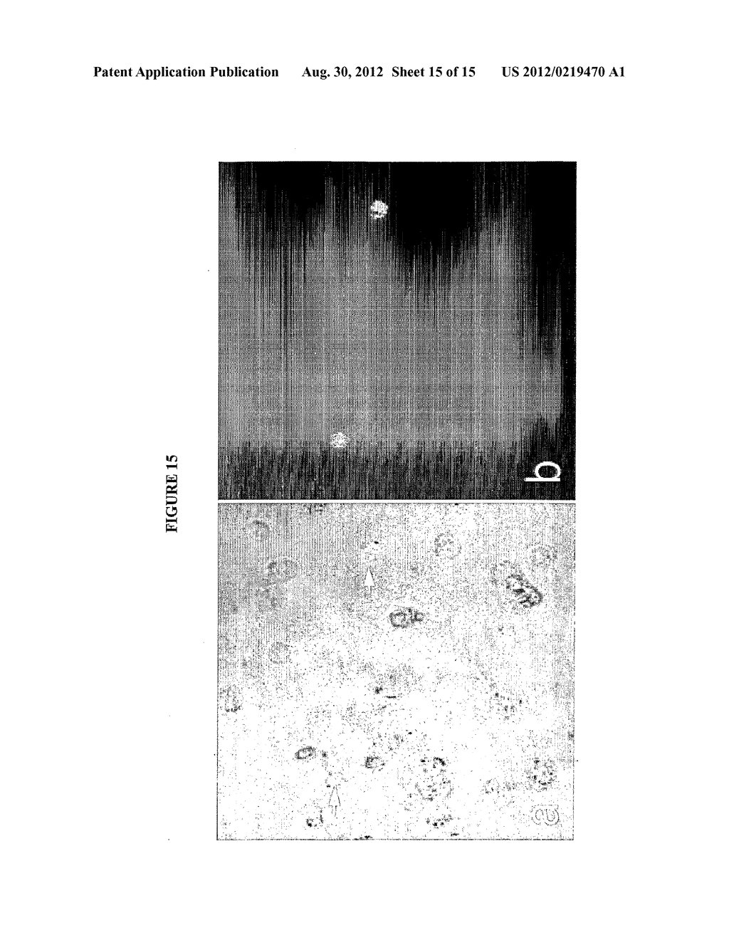 Gel Formulations and Uses Thereof - diagram, schematic, and image 16