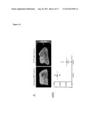 COMPOSITIONS AND METHODS FOR DETECTING PLECTIN-1 AS A BIOMARKER FOR CANCER diagram and image