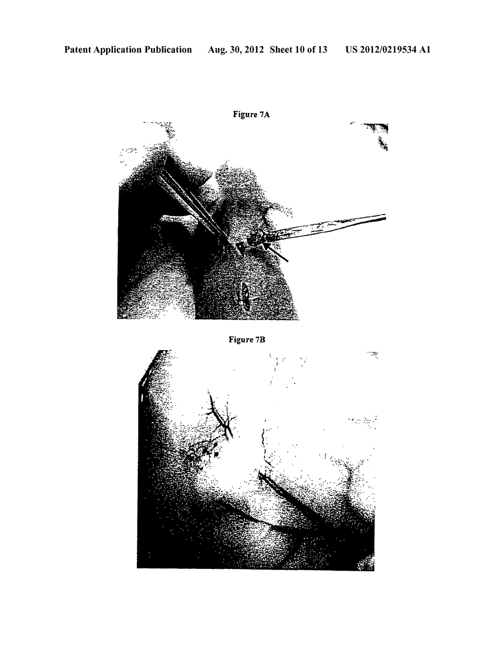 FREEZE-DRIED FIBRIN MATRICES AND METHODS FOR PREPARATION THEREOF - diagram, schematic, and image 11