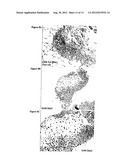 FREEZE-DRIED FIBRIN MATRICES AND METHODS FOR PREPARATION THEREOF diagram and image