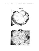FREEZE-DRIED FIBRIN MATRICES AND METHODS FOR PREPARATION THEREOF diagram and image
