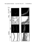 INTRANASAL SPRAY-TYPE TUBERCULOSIS VACCINE USING PARAMYXOVIRUS VECTOR diagram and image