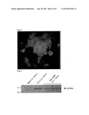 INTRANASAL SPRAY-TYPE TUBERCULOSIS VACCINE USING PARAMYXOVIRUS VECTOR diagram and image