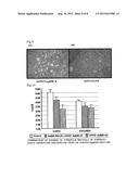 INTRANASAL SPRAY-TYPE TUBERCULOSIS VACCINE USING PARAMYXOVIRUS VECTOR diagram and image