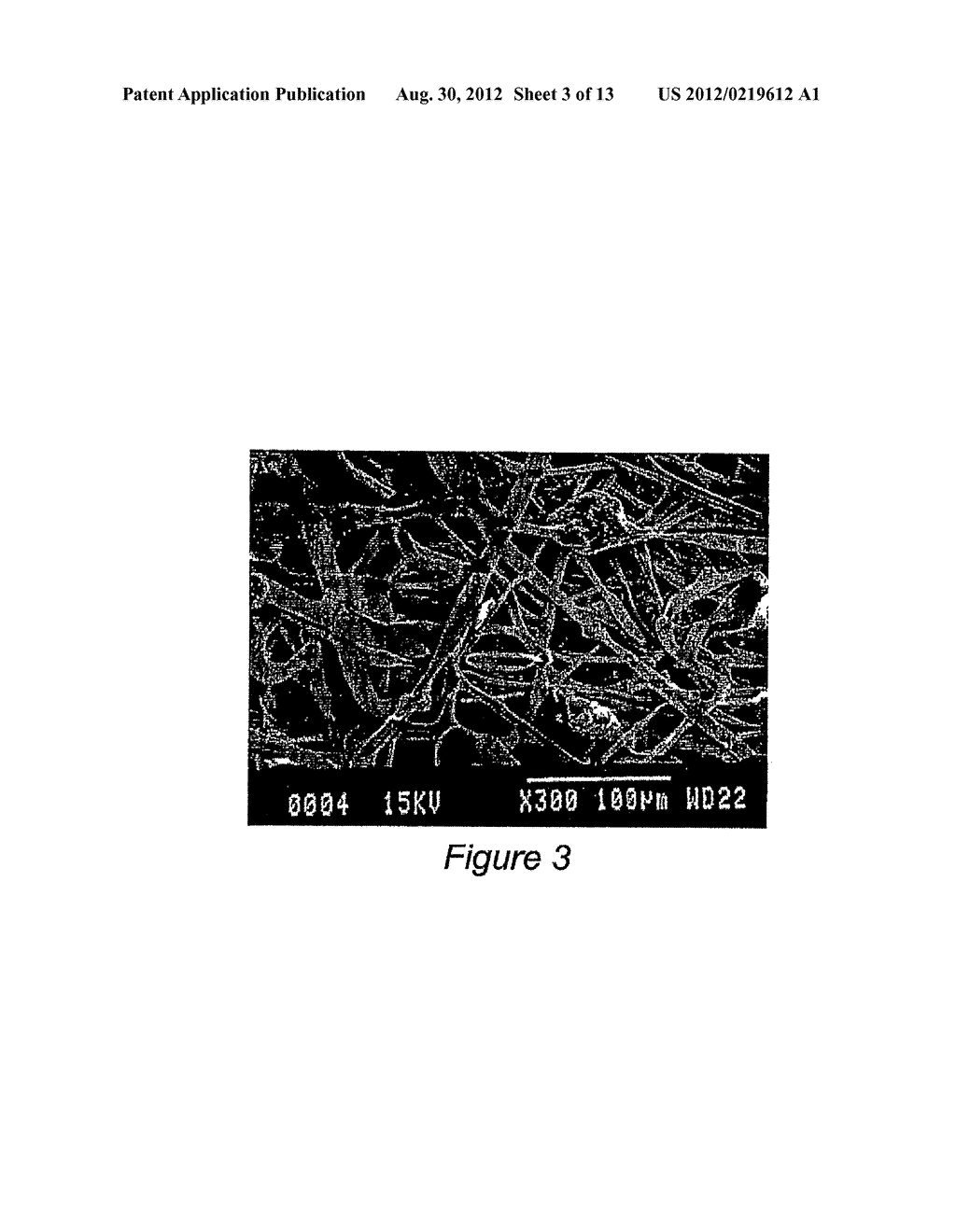 Mineral Technologies (MT) for Acute Hemostasis and for the Treatment of     Acute Wounds and Chronic Ulcers - diagram, schematic, and image 04