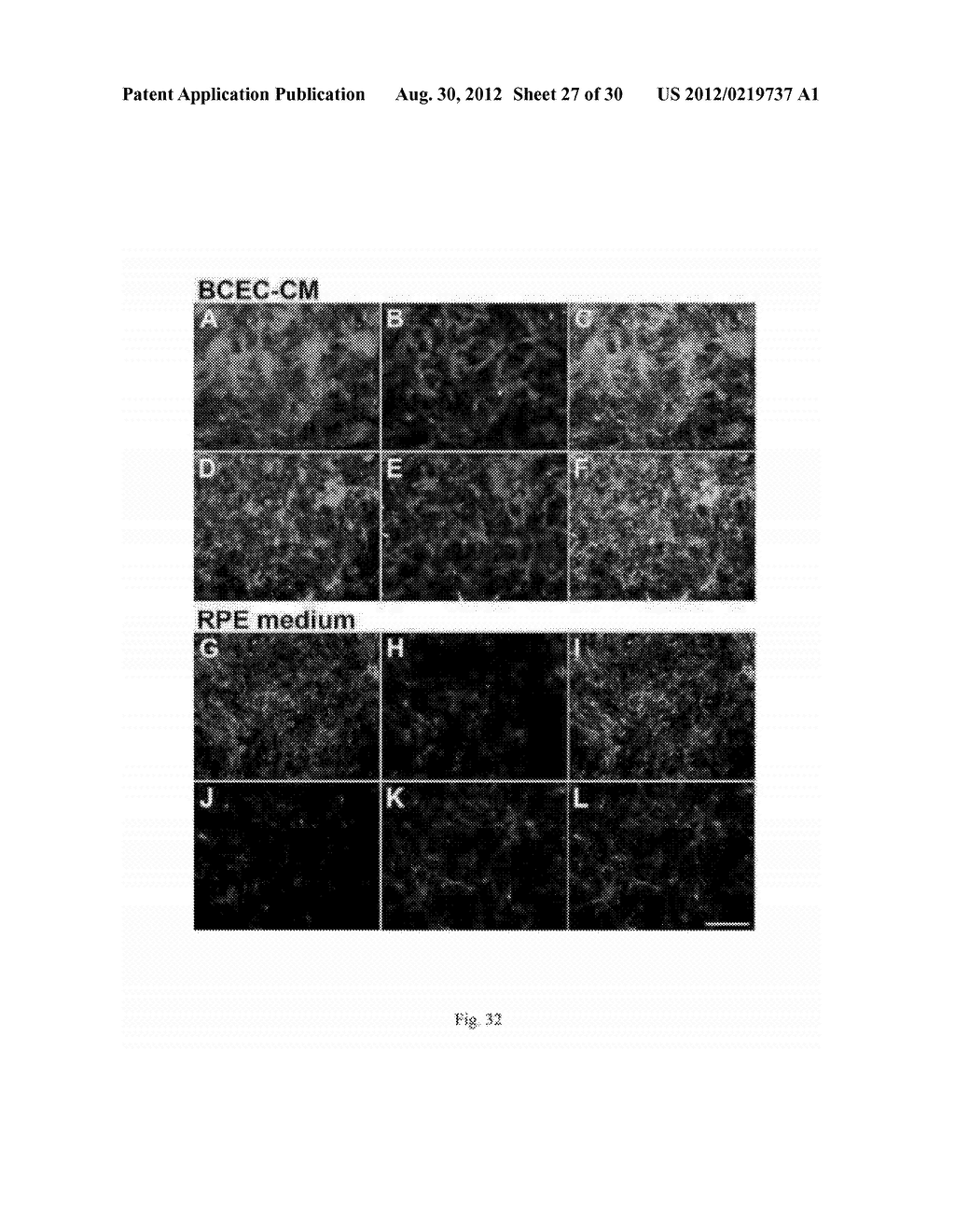 Production of extracellular matrix, conditioned media and uses thereof - diagram, schematic, and image 28