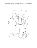 DENTAL INSTRUMENT diagram and image