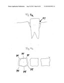 DENTAL INSTRUMENT diagram and image