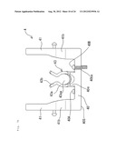 ARTICULATOR diagram and image