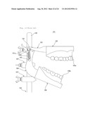 ARTICULATOR diagram and image