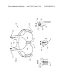 Radiation Treatment Brassiere diagram and image