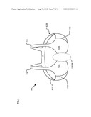 Radiation Treatment Brassiere diagram and image