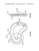 OFFSET WEIGHT BARS diagram and image