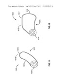 OFFSET WEIGHT BARS diagram and image