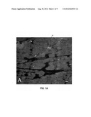 MODULATING NEUROMUSCULAR JUNCTION DENSITY CHANGES IN BOTULINUM-TOXIN     TREATED TISSUE diagram and image