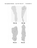 MODULATING NEUROMUSCULAR JUNCTION DENSITY CHANGES IN BOTULINUM-TOXIN     TREATED TISSUE diagram and image