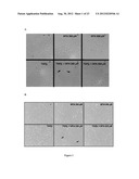 COMPOSTIONS DESIGNED FOR THE INHIBITION AND/OR BLOCKING OF THE     EPITHELIAL/MESENCHYMAL TRANSITION diagram and image