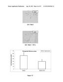 COMPOSTIONS DESIGNED FOR THE INHIBITION AND/OR BLOCKING OF THE     EPITHELIAL/MESENCHYMAL TRANSITION diagram and image