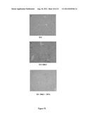 COMPOSTIONS DESIGNED FOR THE INHIBITION AND/OR BLOCKING OF THE     EPITHELIAL/MESENCHYMAL TRANSITION diagram and image