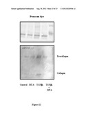 COMPOSTIONS DESIGNED FOR THE INHIBITION AND/OR BLOCKING OF THE     EPITHELIAL/MESENCHYMAL TRANSITION diagram and image