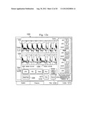 Multipurpose Host System for Invasive Cardiovascular Diagnostic     Measurement Acquisition and Display diagram and image