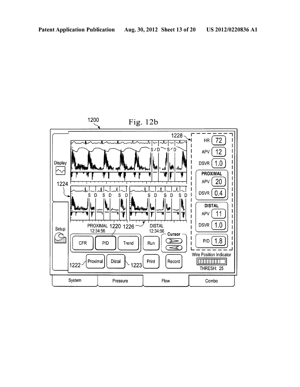 Multipurpose Host System for Invasive Cardiovascular Diagnostic     Measurement Acquisition and Display - diagram, schematic, and image 14