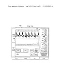 Multipurpose Host System for Invasive Cardiovascular Diagnostic     Measurement Acquisition and Display diagram and image