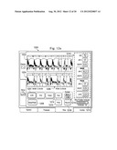 Multipurpose Host System for Invasive Cardiovascular Diagnostic     Measurement Acquisition and Display diagram and image