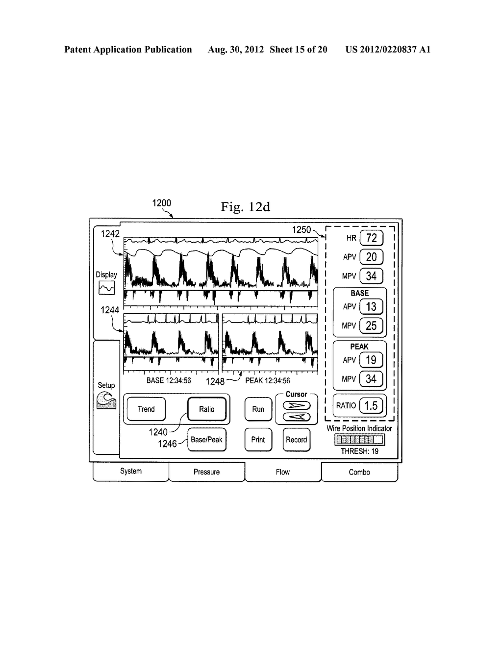 Multipurpose Host System for Invasive Cardiovascular Diagnostic     Measurement Acquisition and Display - diagram, schematic, and image 16