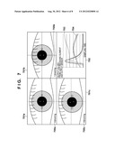 OPHTHALMIC APPARATUS AND STORAGE MEDIUM diagram and image