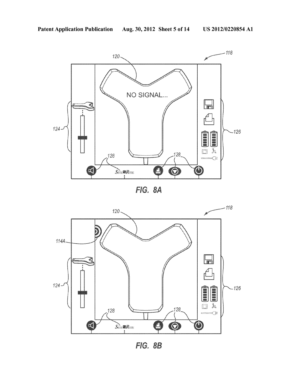 Integrated System for Intravascular Placement of a Catheter - diagram, schematic, and image 06