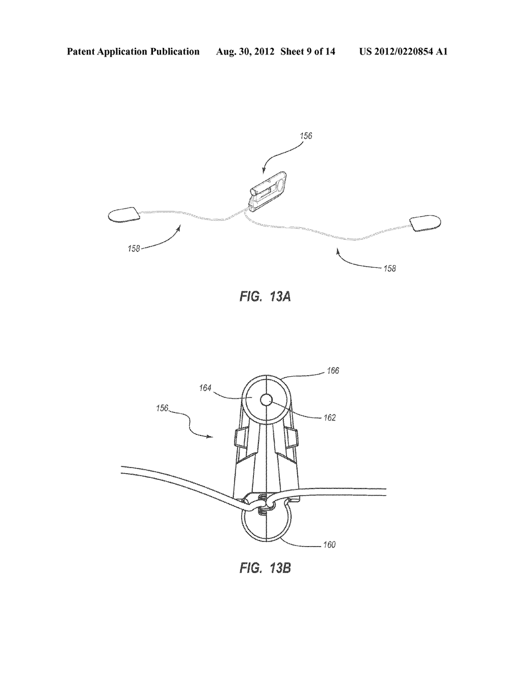 Integrated System for Intravascular Placement of a Catheter - diagram, schematic, and image 10