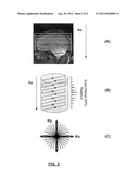 IMAGING-BASED DIAGNOSTIC APPARATUS AND METHODS FOR QUANTIFYING CEREBRAL     VASCULAR RESERVE diagram and image